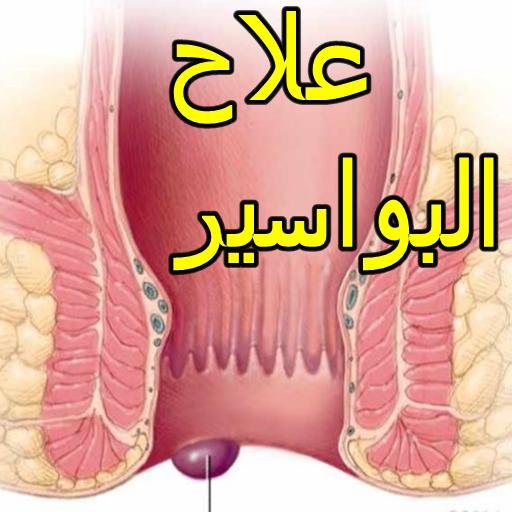 علاجا للبواسير والناصور