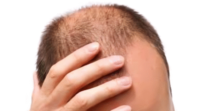الحل السحري لمشكلة تساقط الشعر