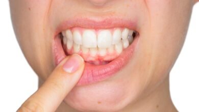 طريقة جديدة لتحضير غشاء فمي لعلاج أمراض الفم واللثة وأنسجة الأسنان