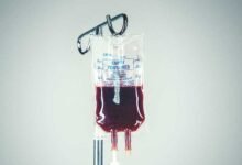 جهاز ينقل دم الشخص لنفسه رخيص الثمن ويحافظ على الصحة