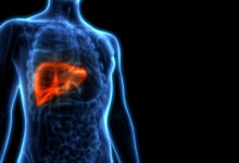 العلاج الشامل لارتفاع سكر الدم ودهون الكبد